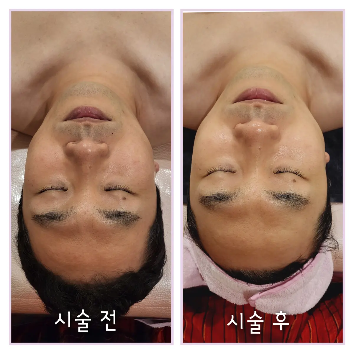이미지 4