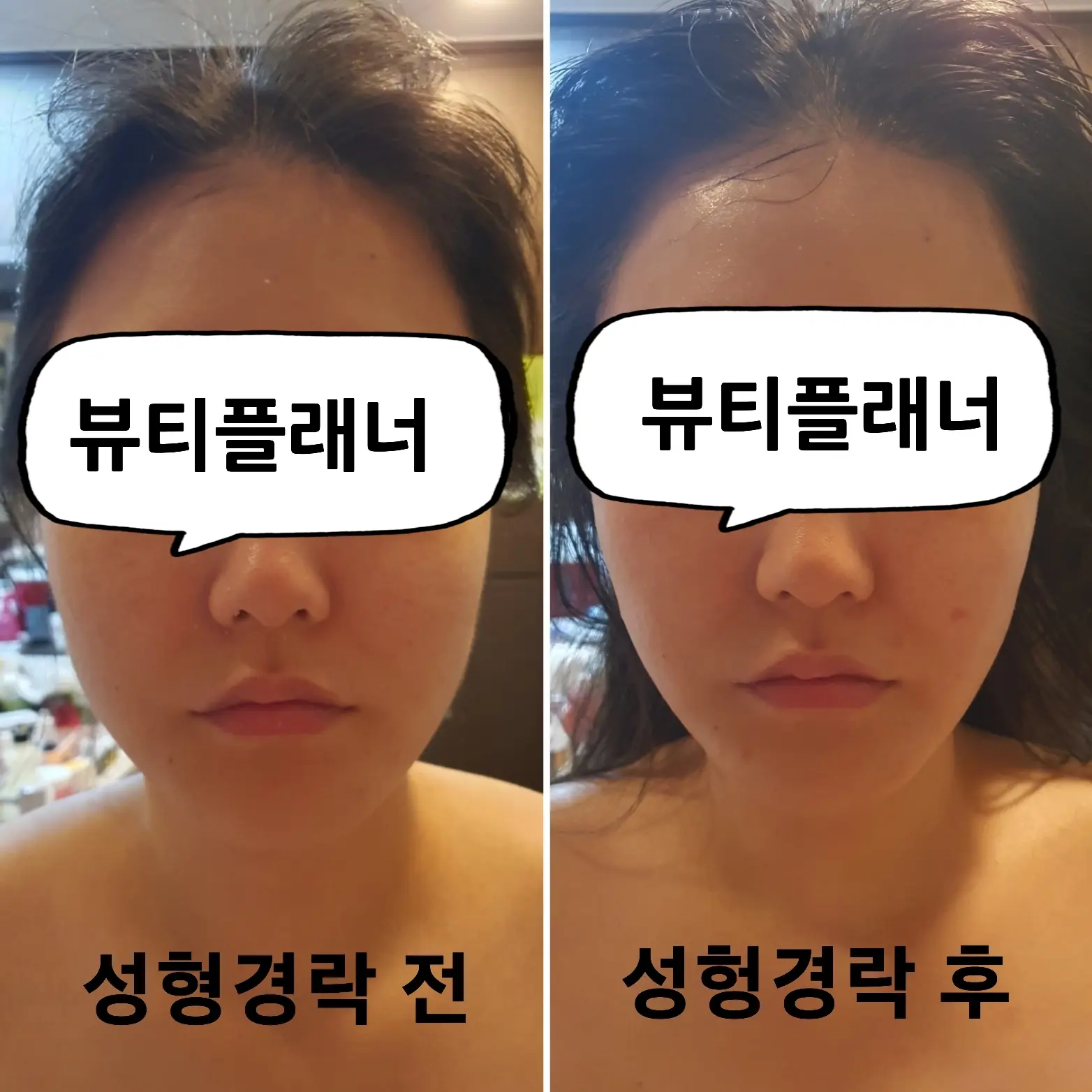 이미지 9