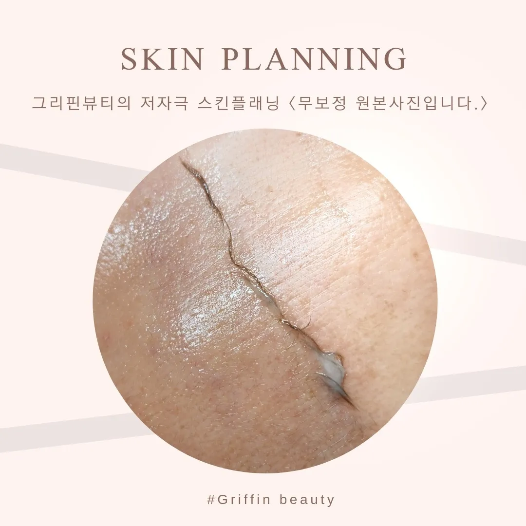 이미지 7