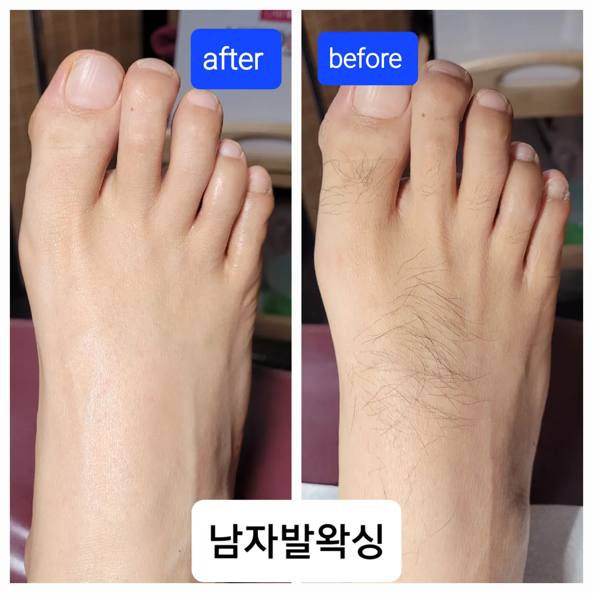 이미지 5