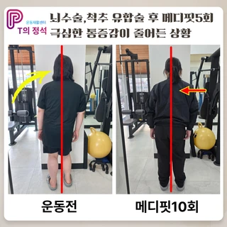 뇌수술·척추유합술 후, 맞춤형 재활 PT로 되찾은 일상과 활력