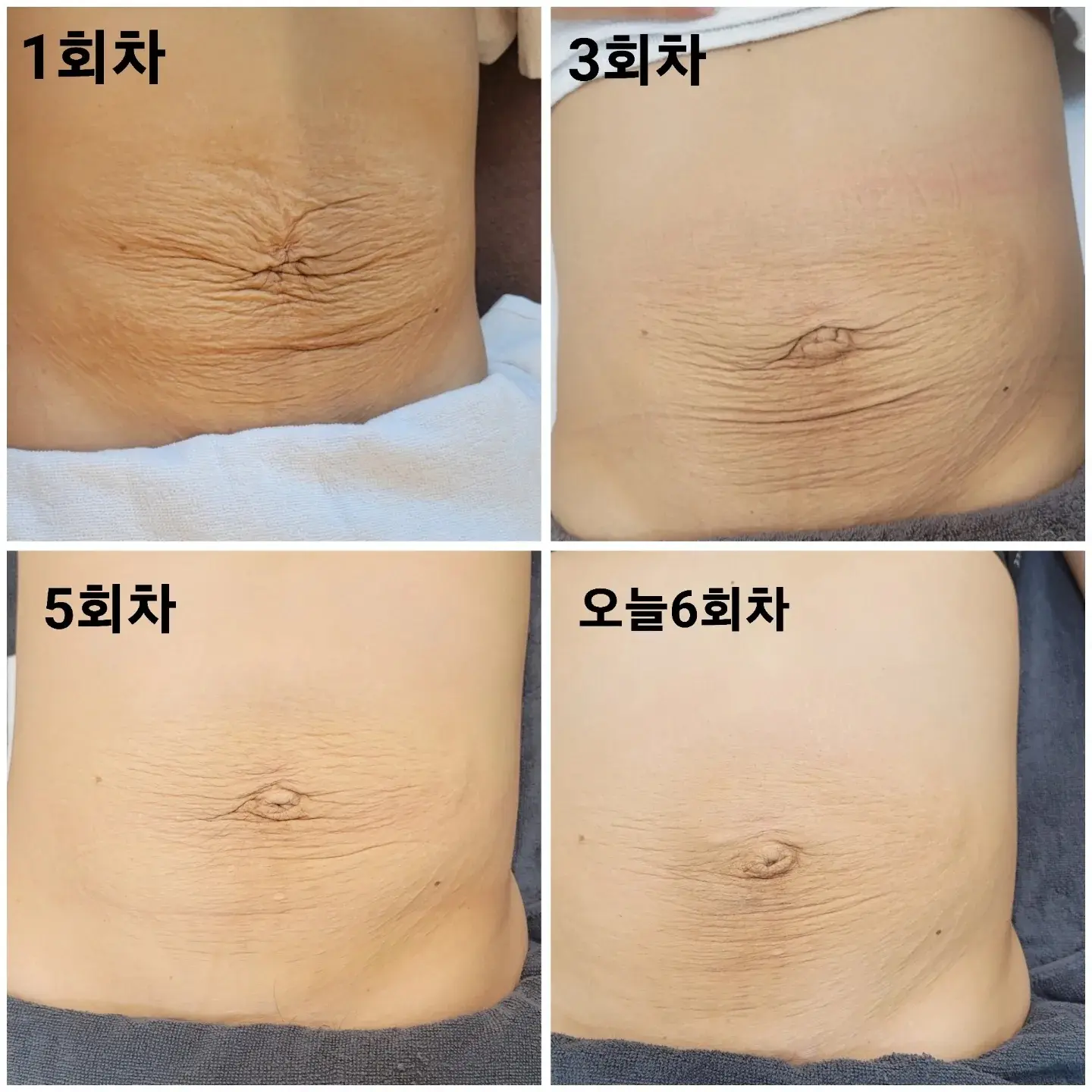 이미지 9
