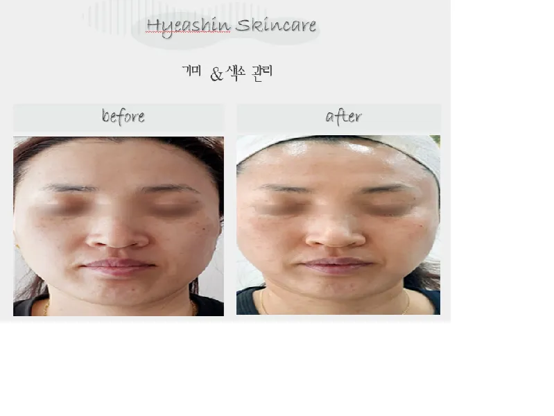 이미지 11