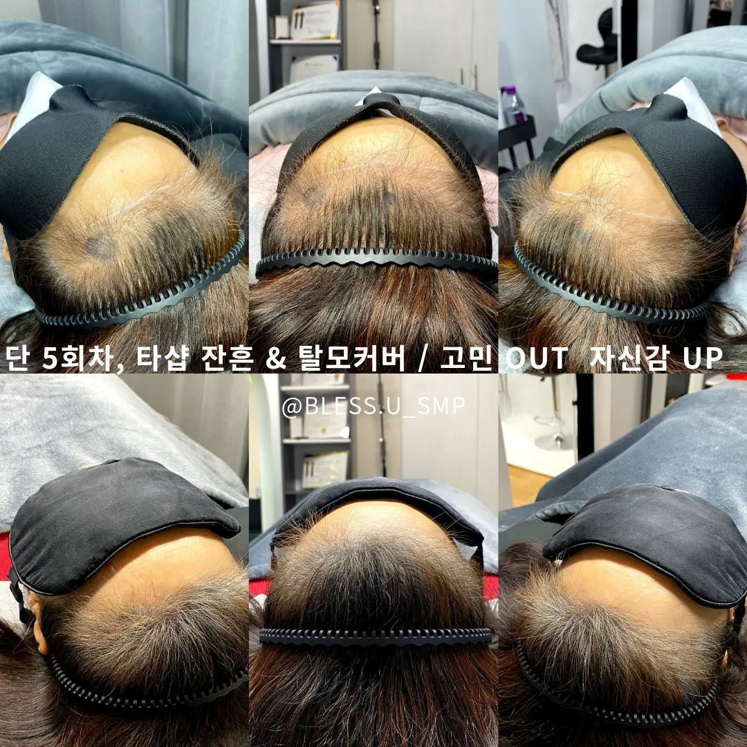 이미지 12