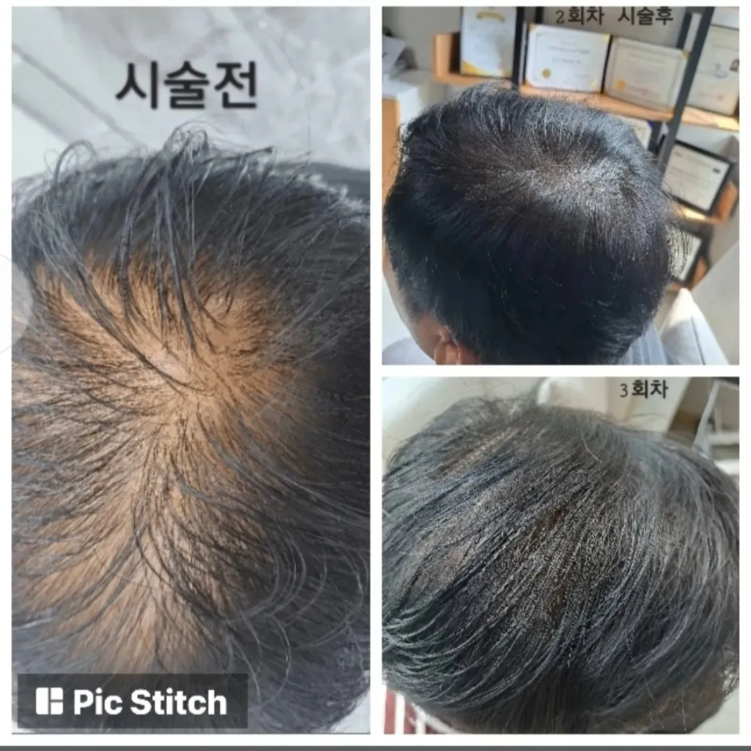 이미지 16