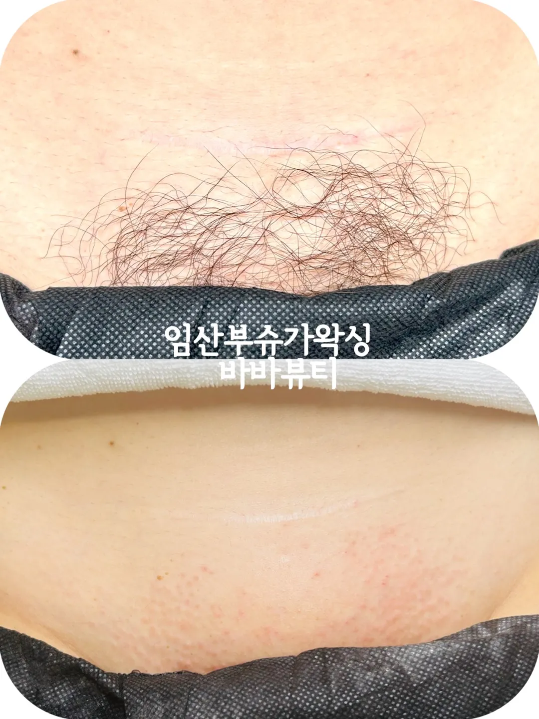이미지 6