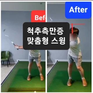 S자 척추측만증을 지니고 계신 회원님