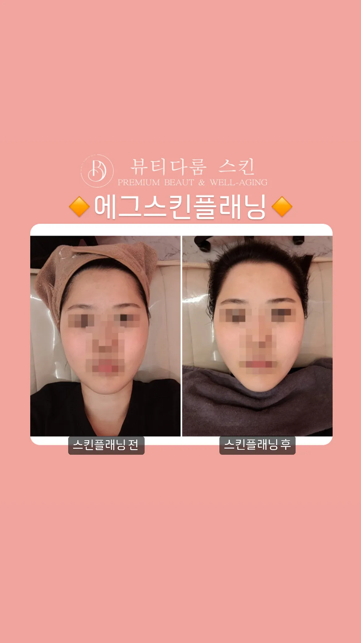 이미지 5