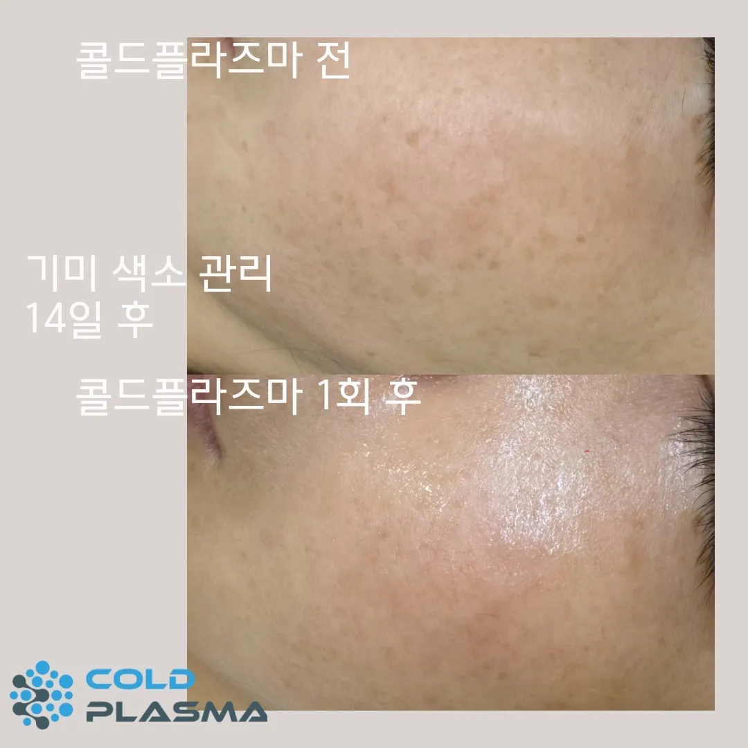 이미지 9
