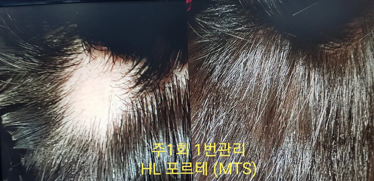 이미지 6