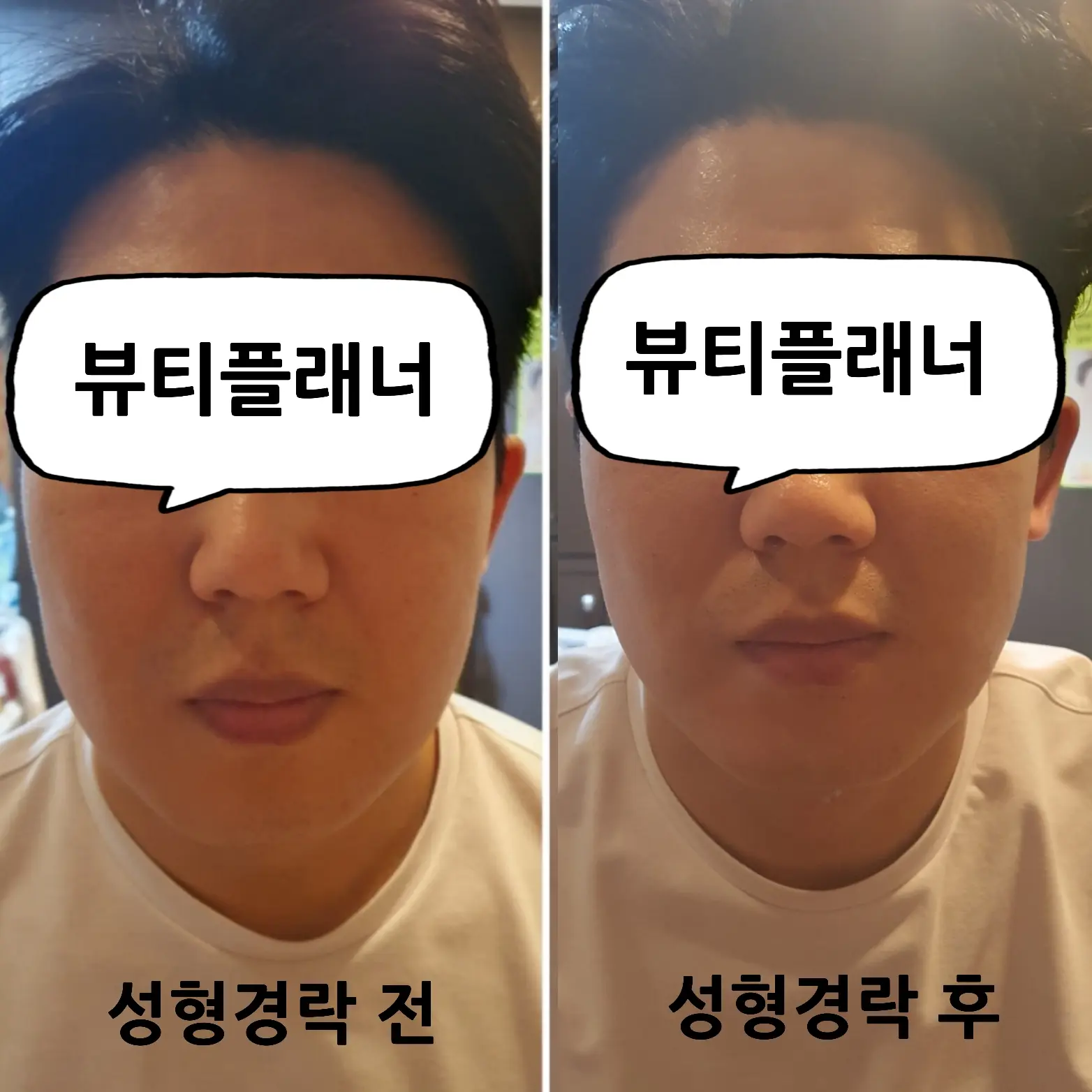 이미지 10