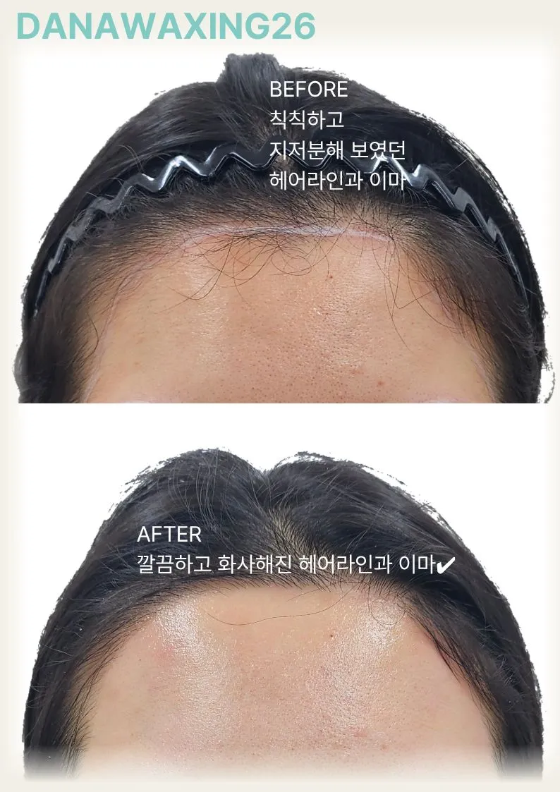 이미지 2