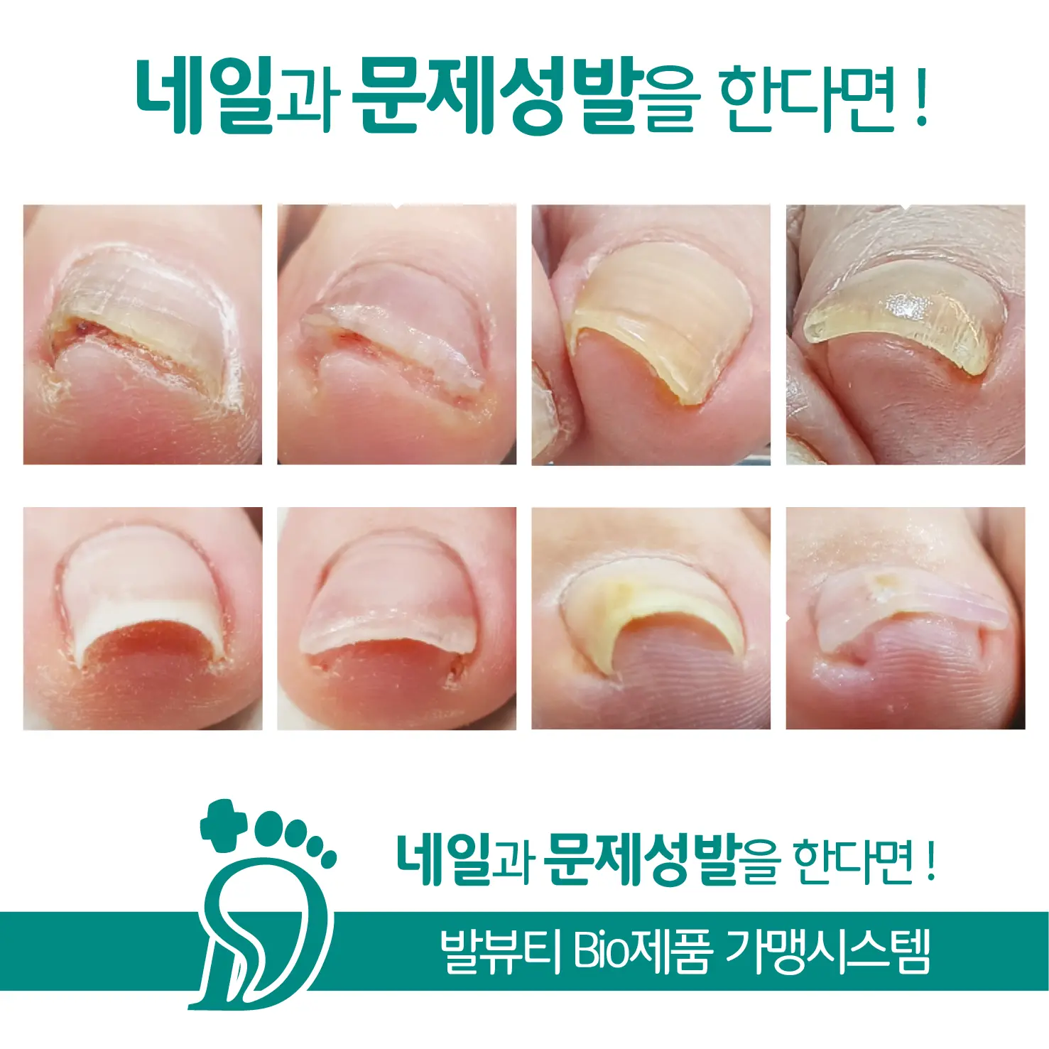 이미지 12