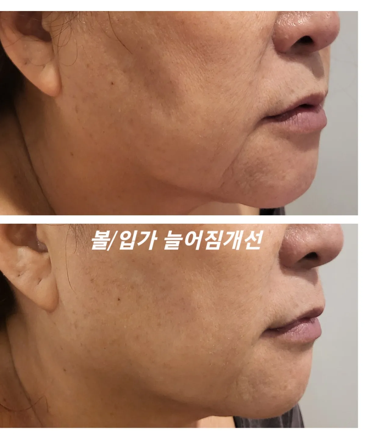 이미지 9