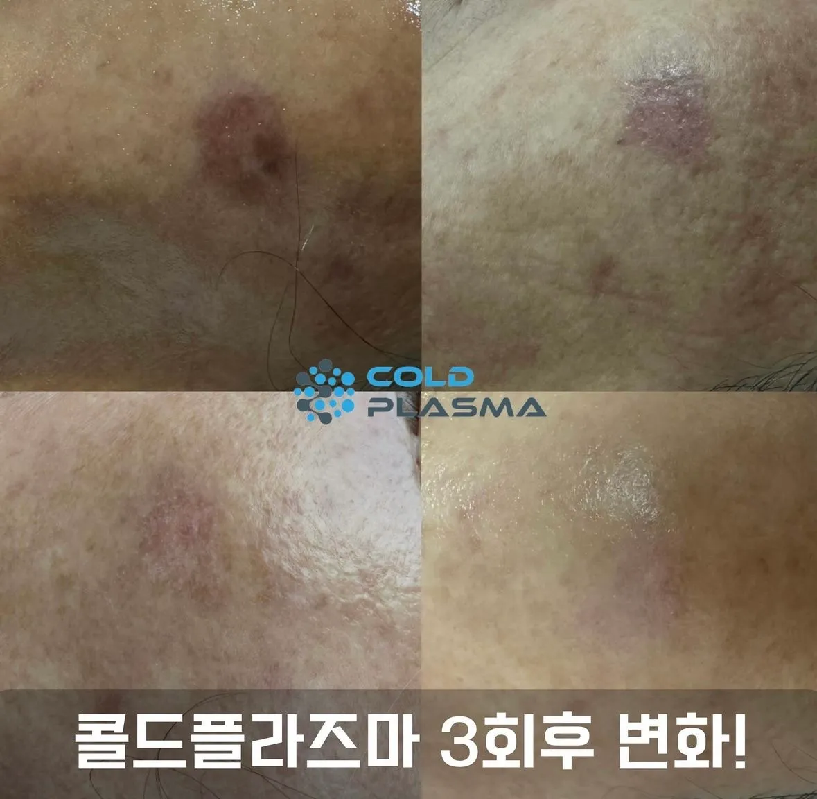 이미지 3