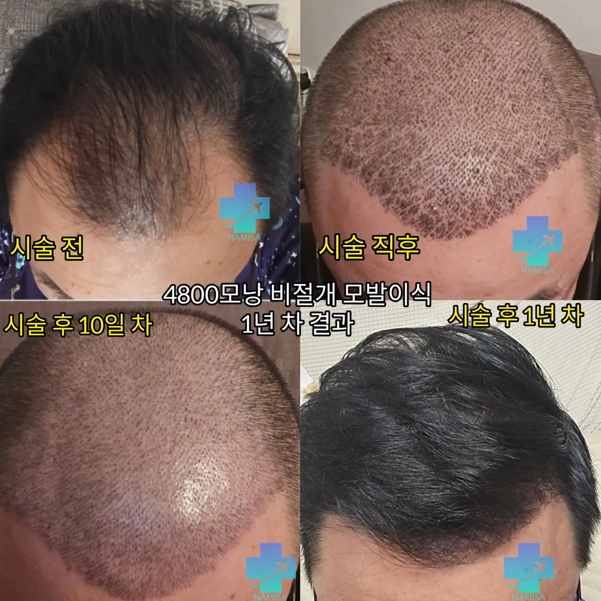 이미지 8