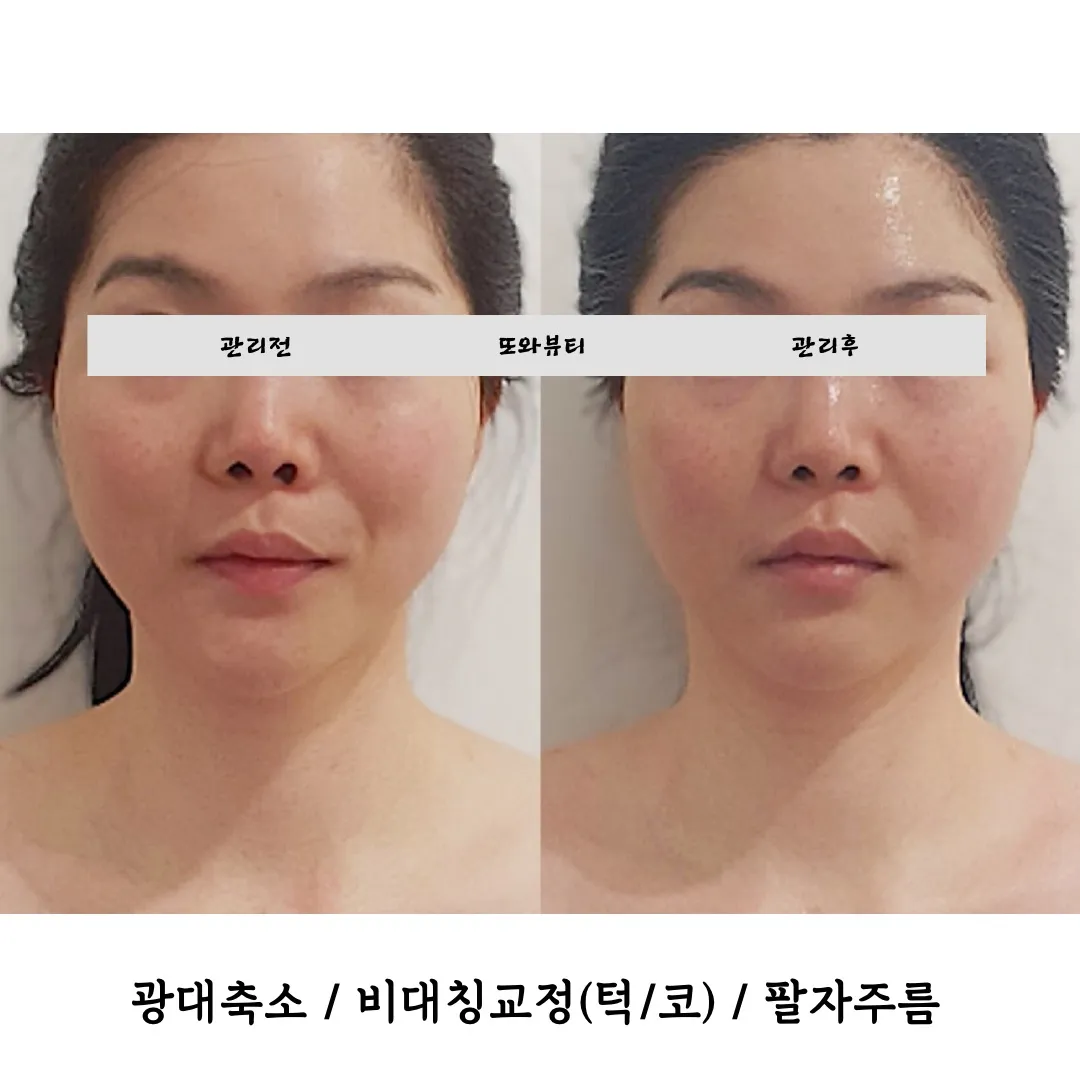 이미지 4