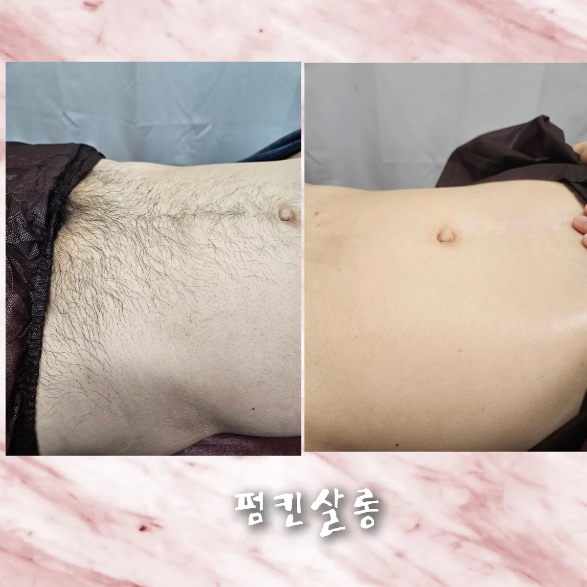 이미지 3