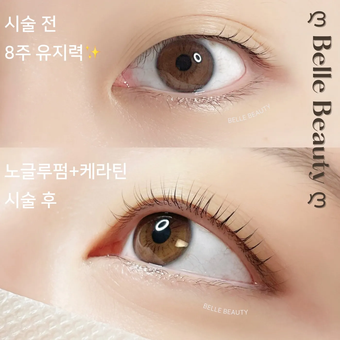 이미지 5