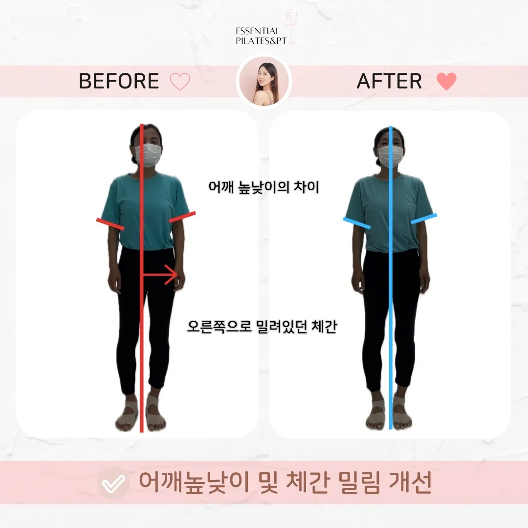 이미지 7