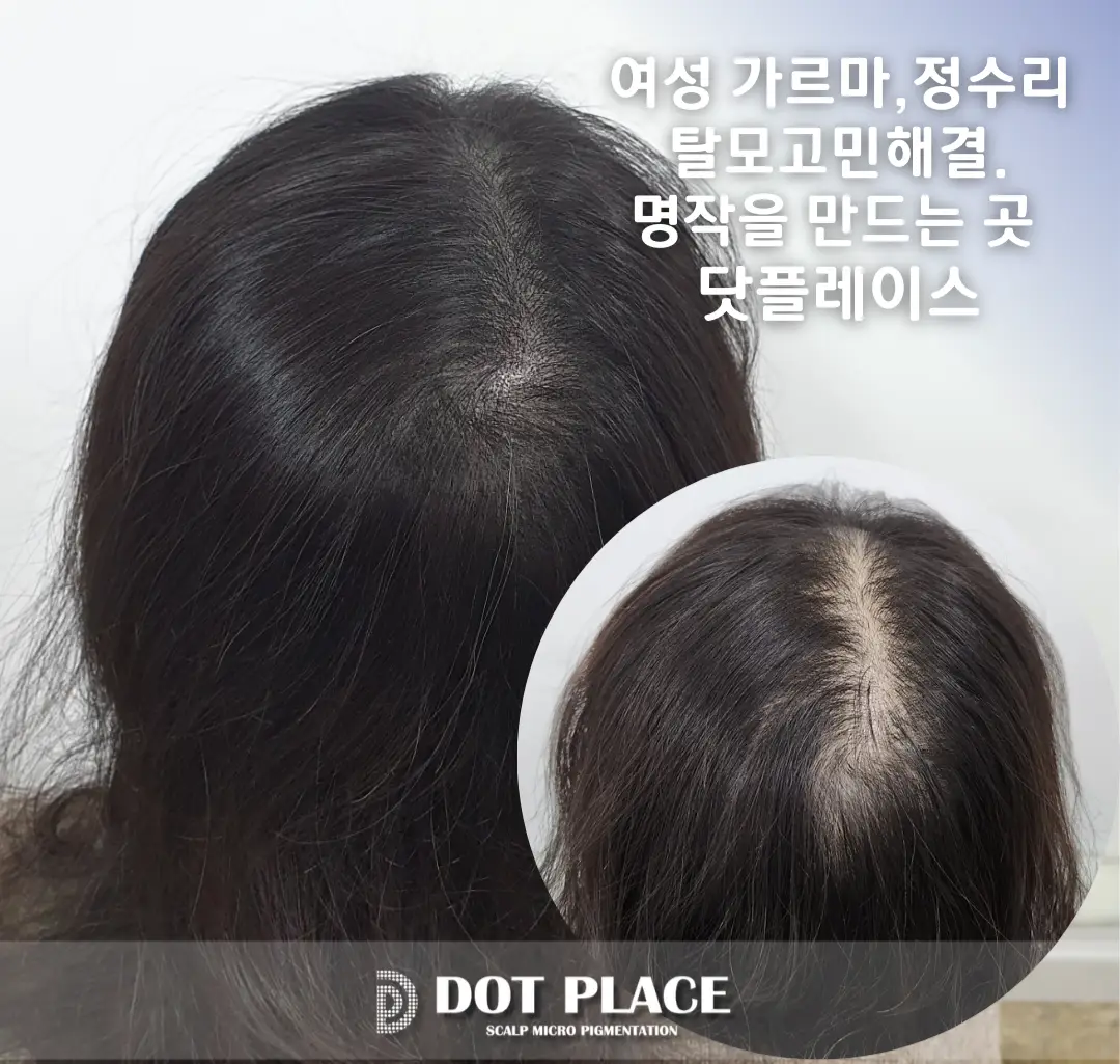 이미지 5
