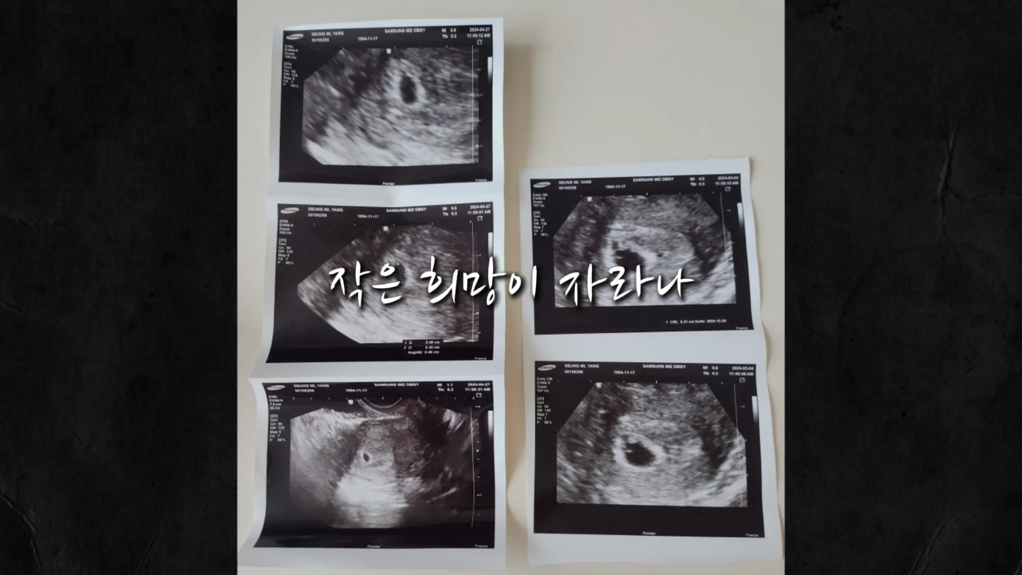 이미지 2