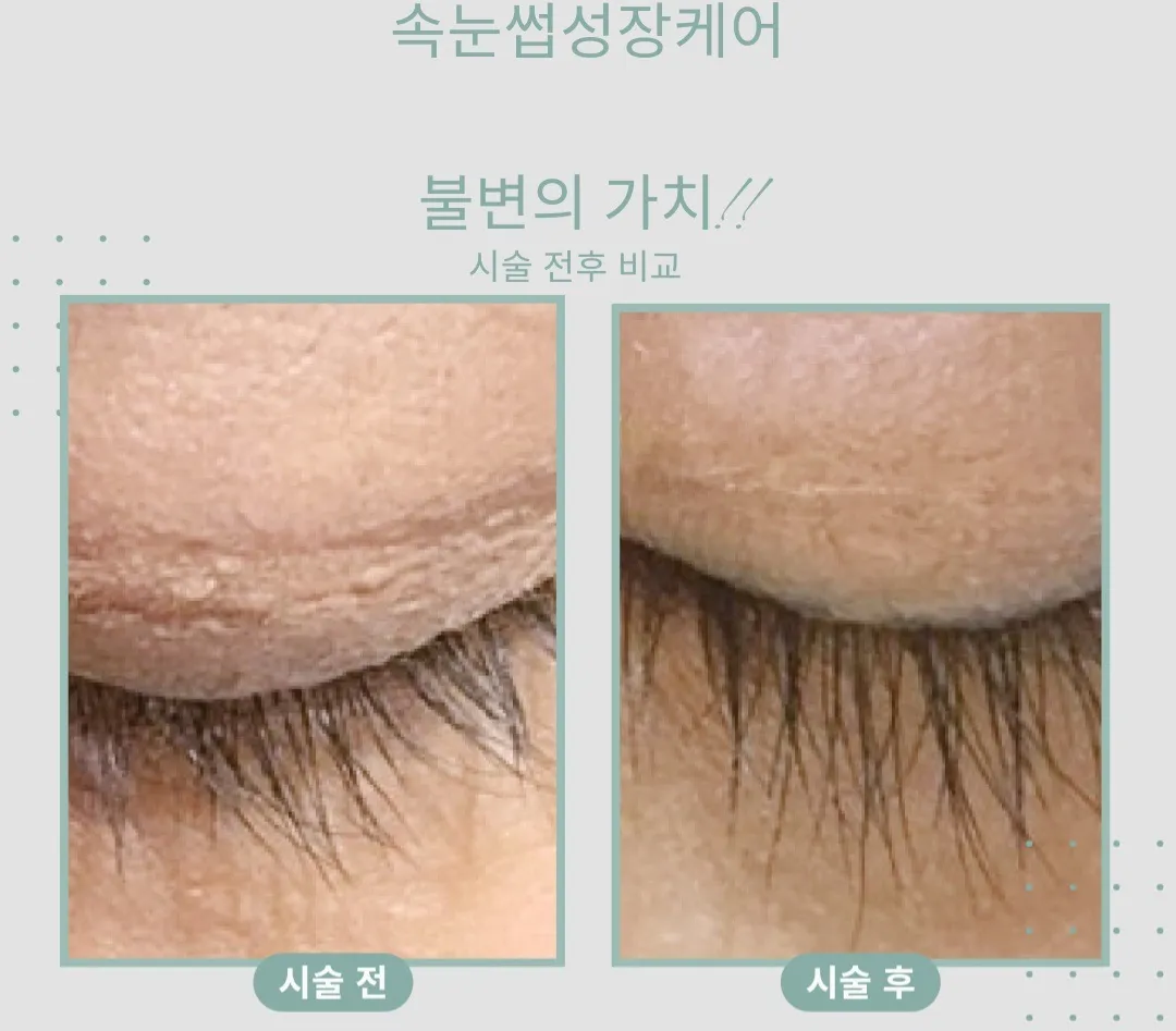 이미지 4