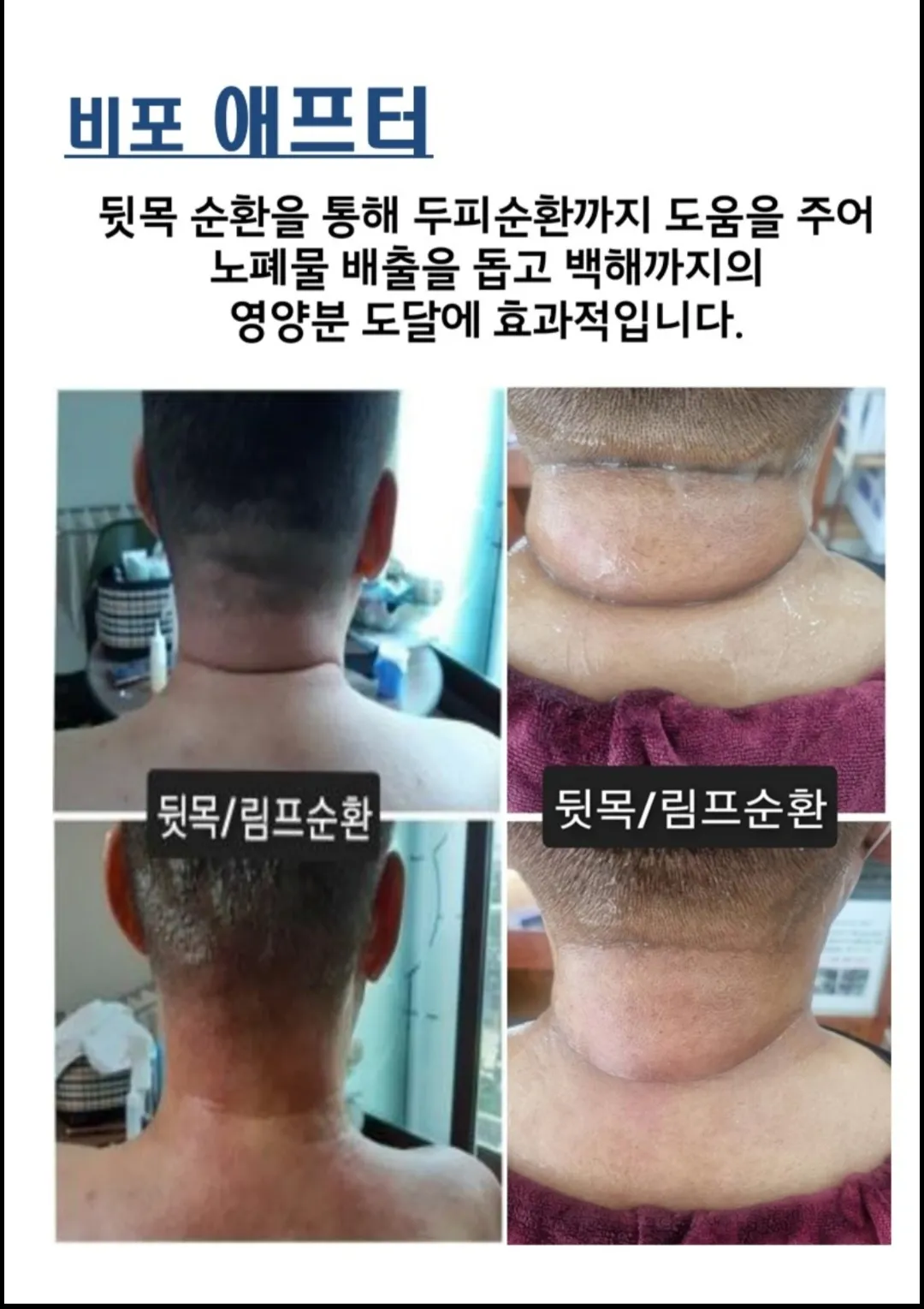 이미지 12