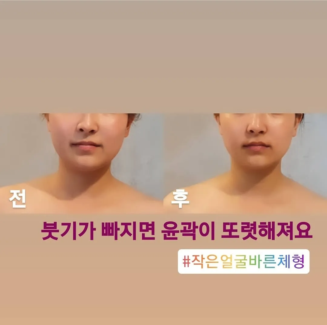 이미지 7