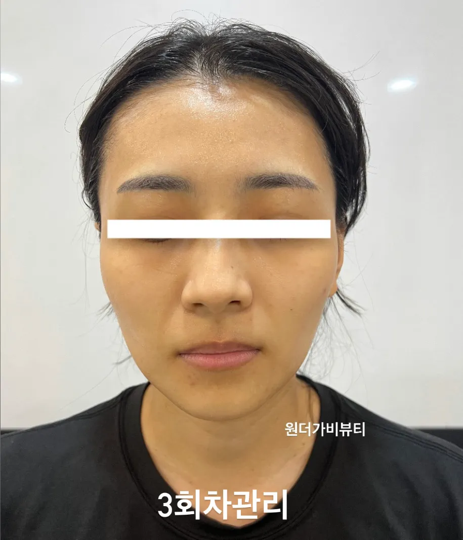 이미지 4