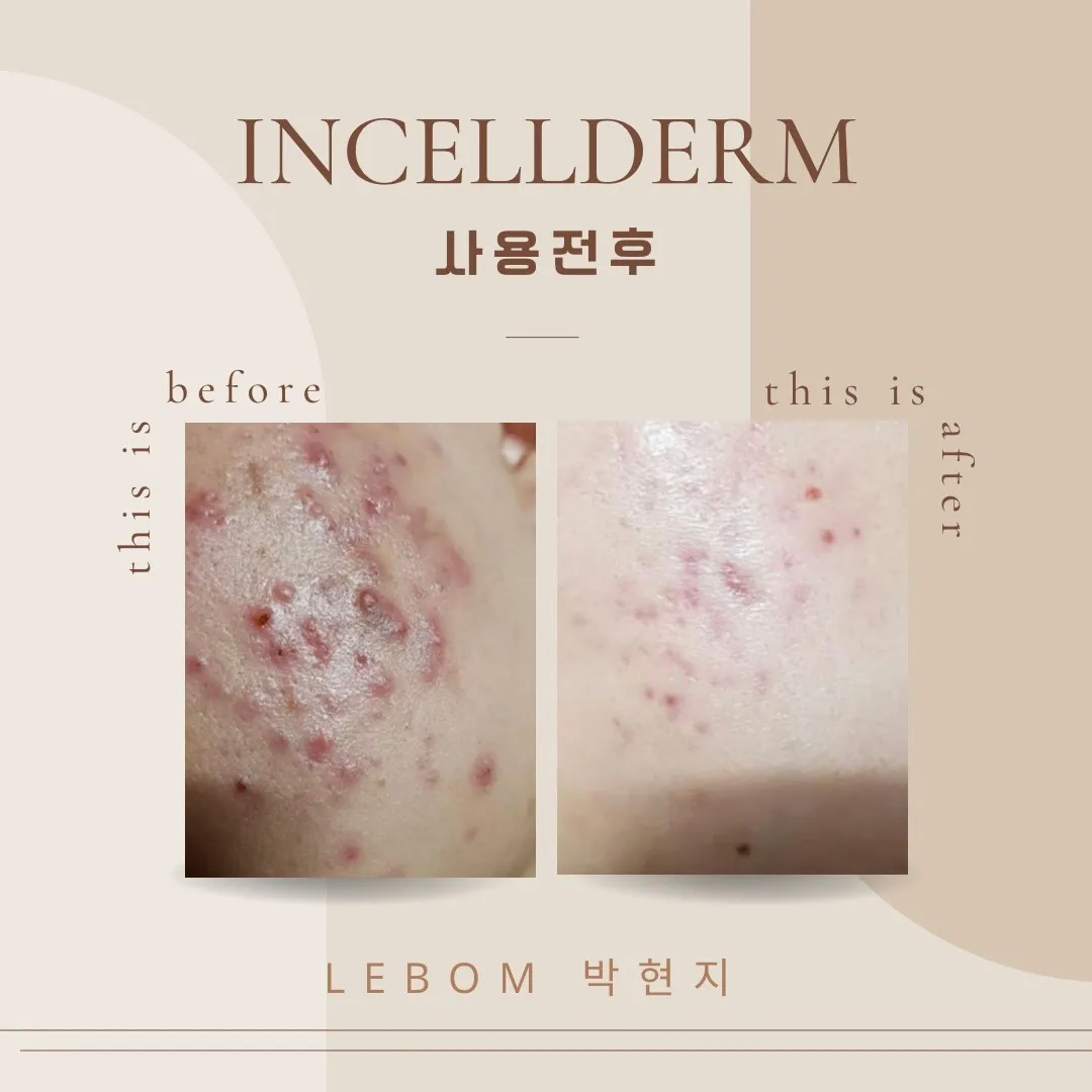이미지 2