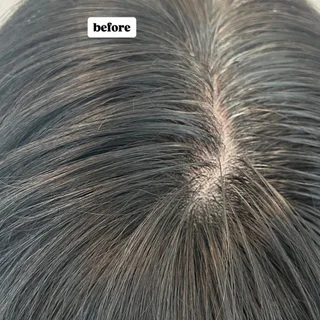 남성 정수리