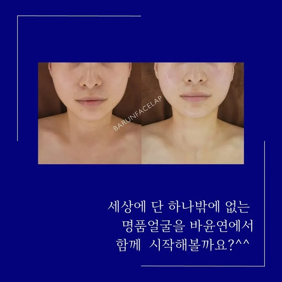 이미지 10