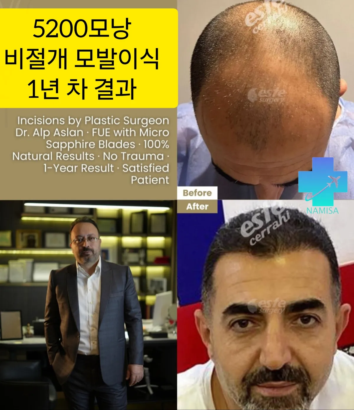 이미지 28