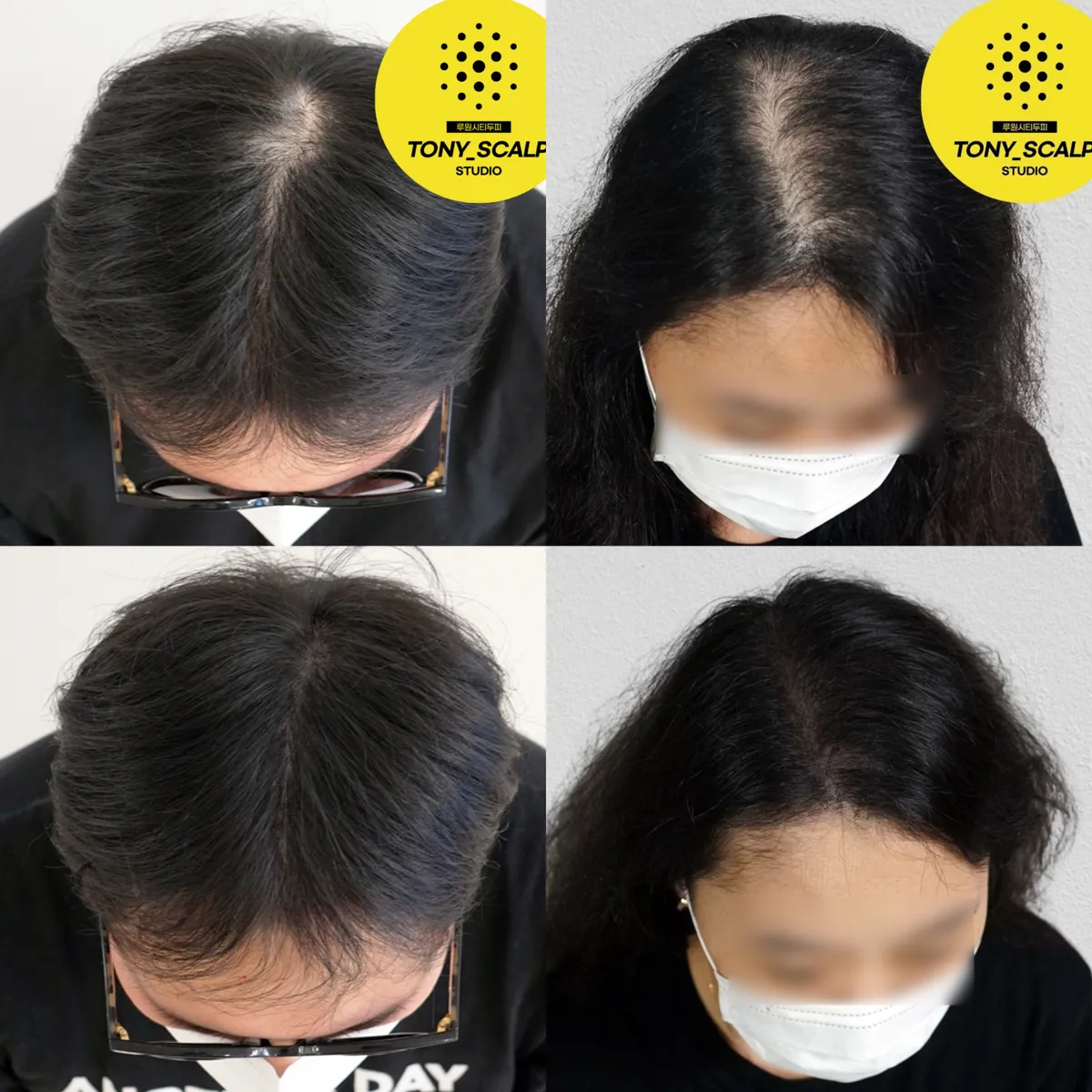 이미지 7