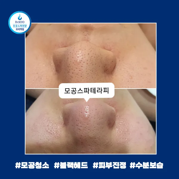 이미지 4