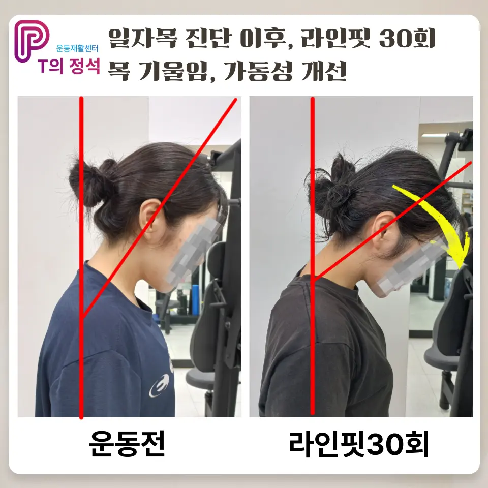 이미지 14