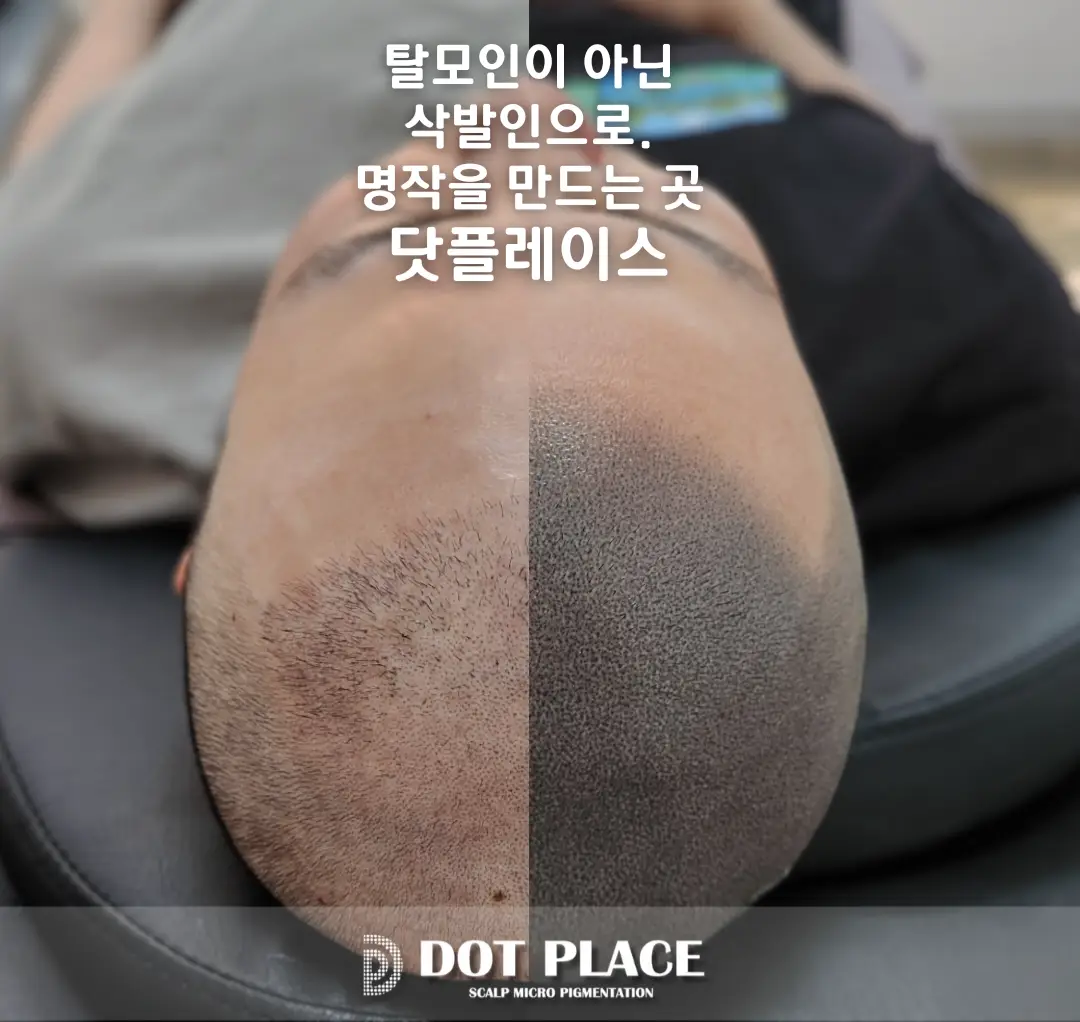 이미지 12