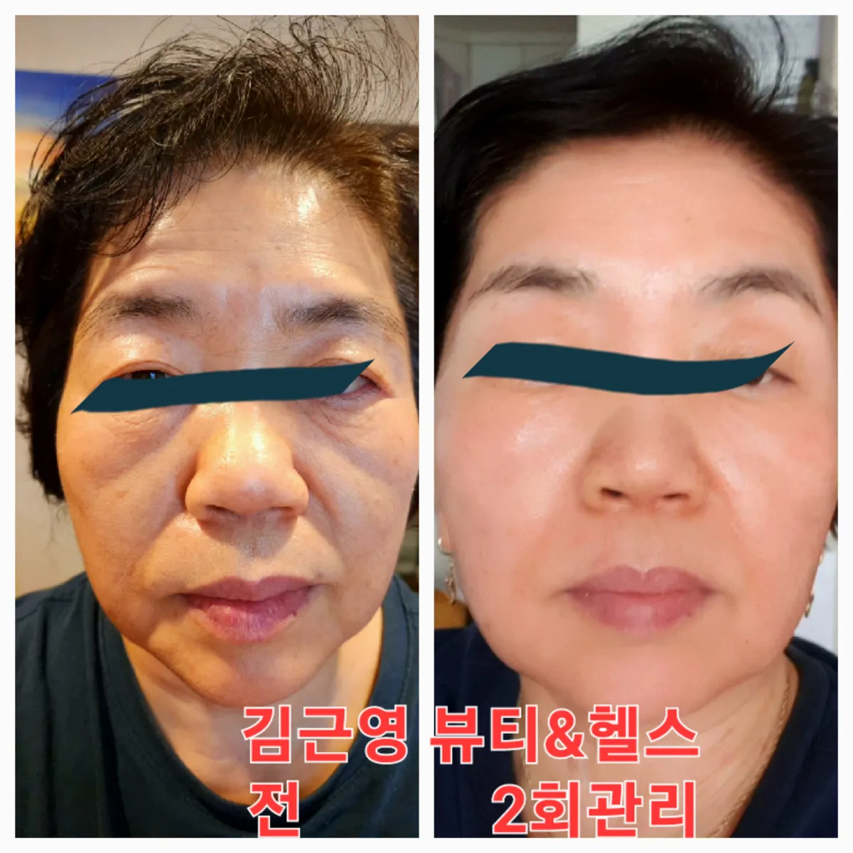 이미지 5