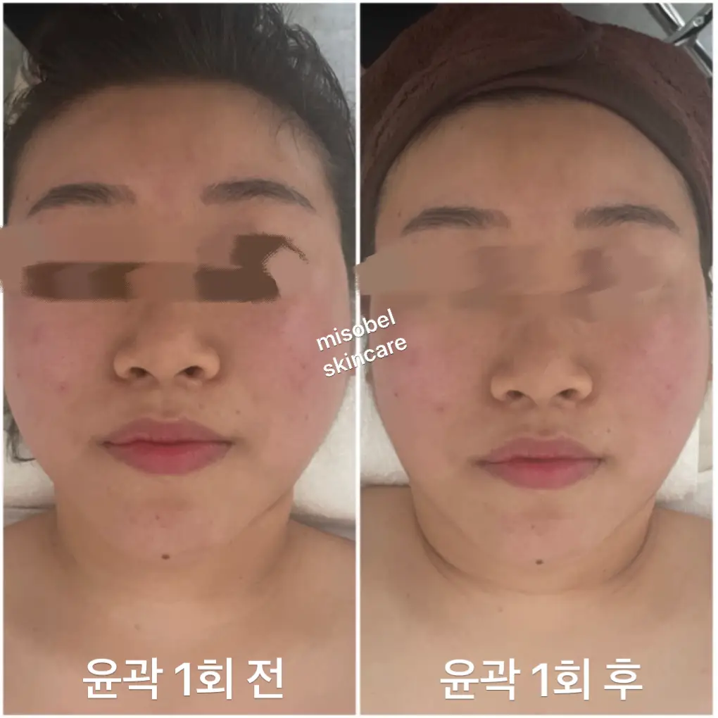 이미지 3
