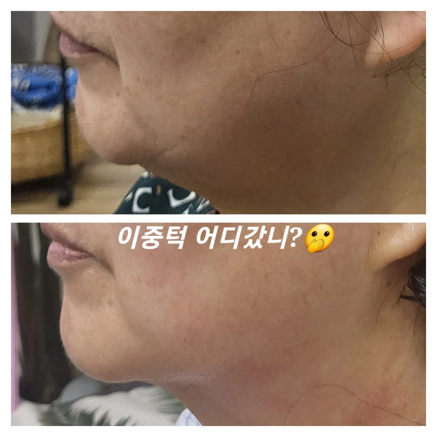 이미지 8
