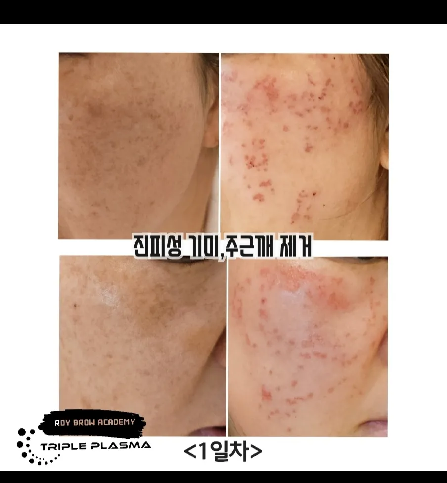 이미지 11