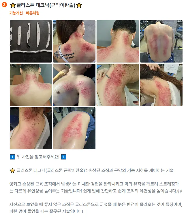 이미지 3