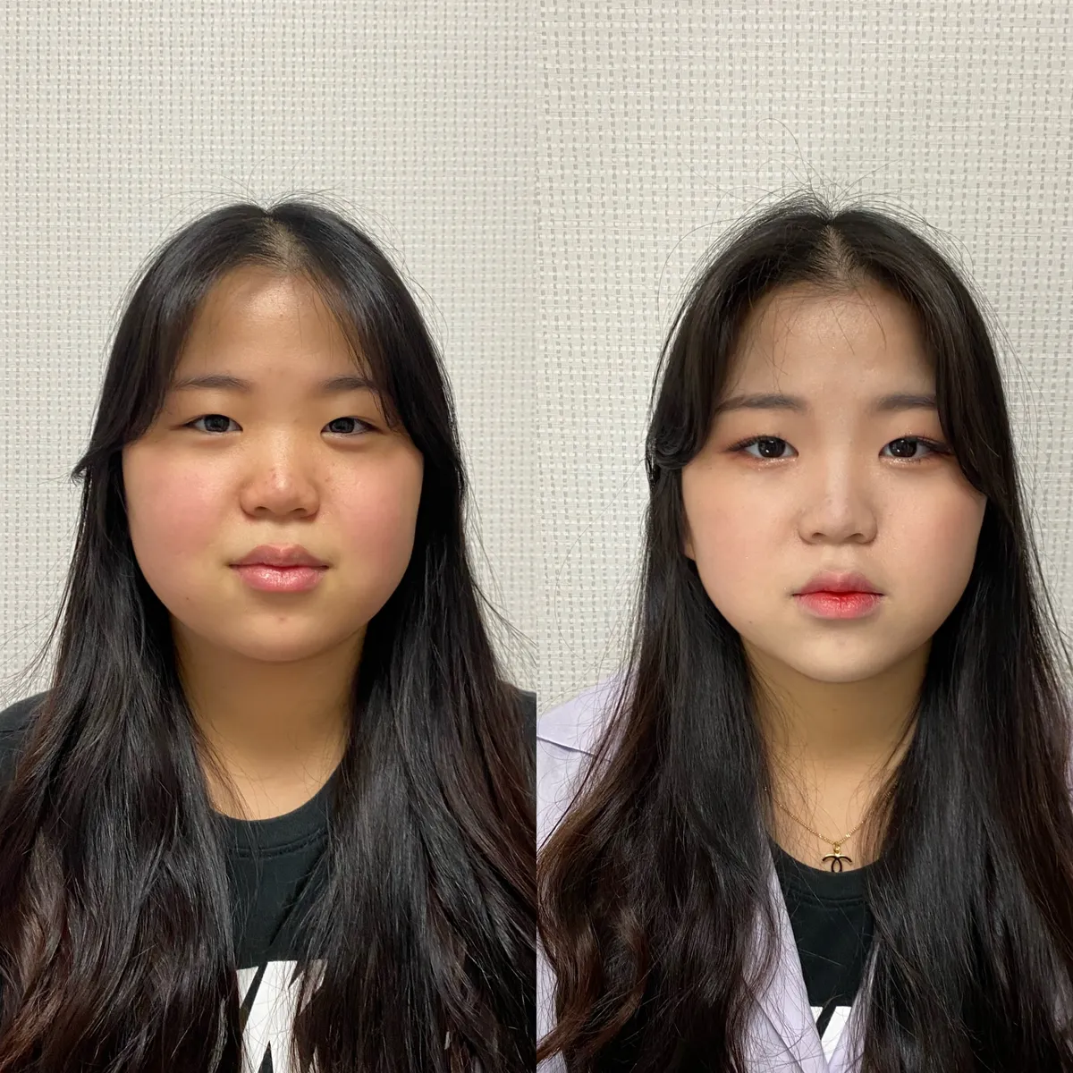 이미지 6
