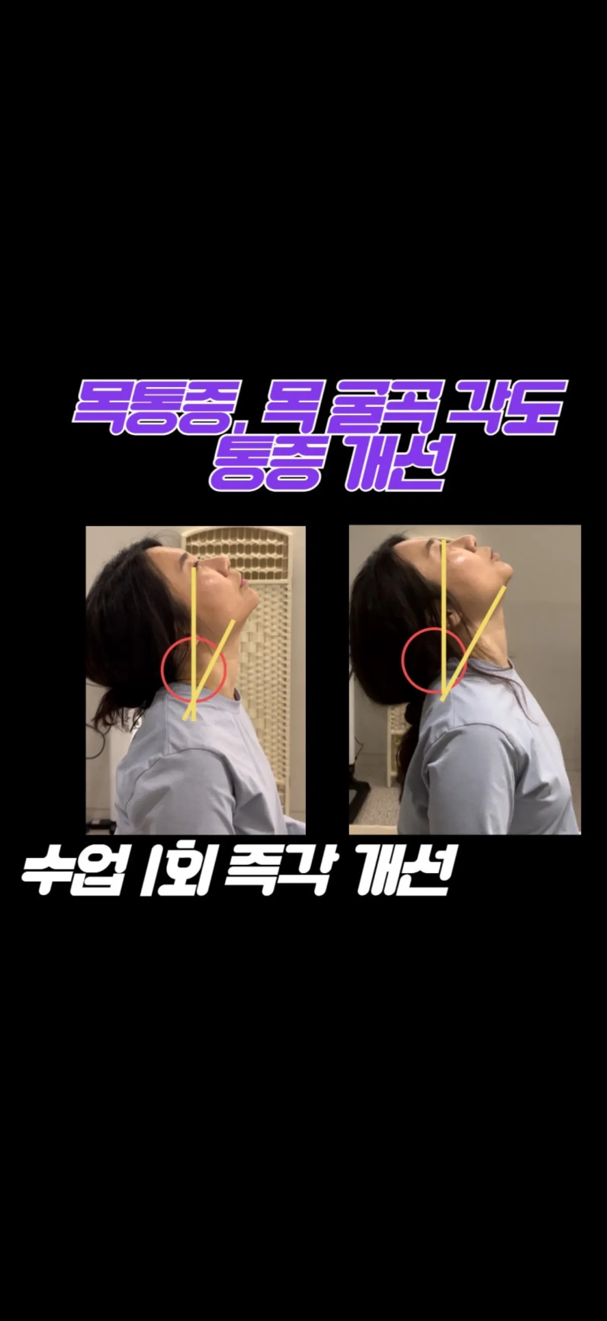 이미지 10