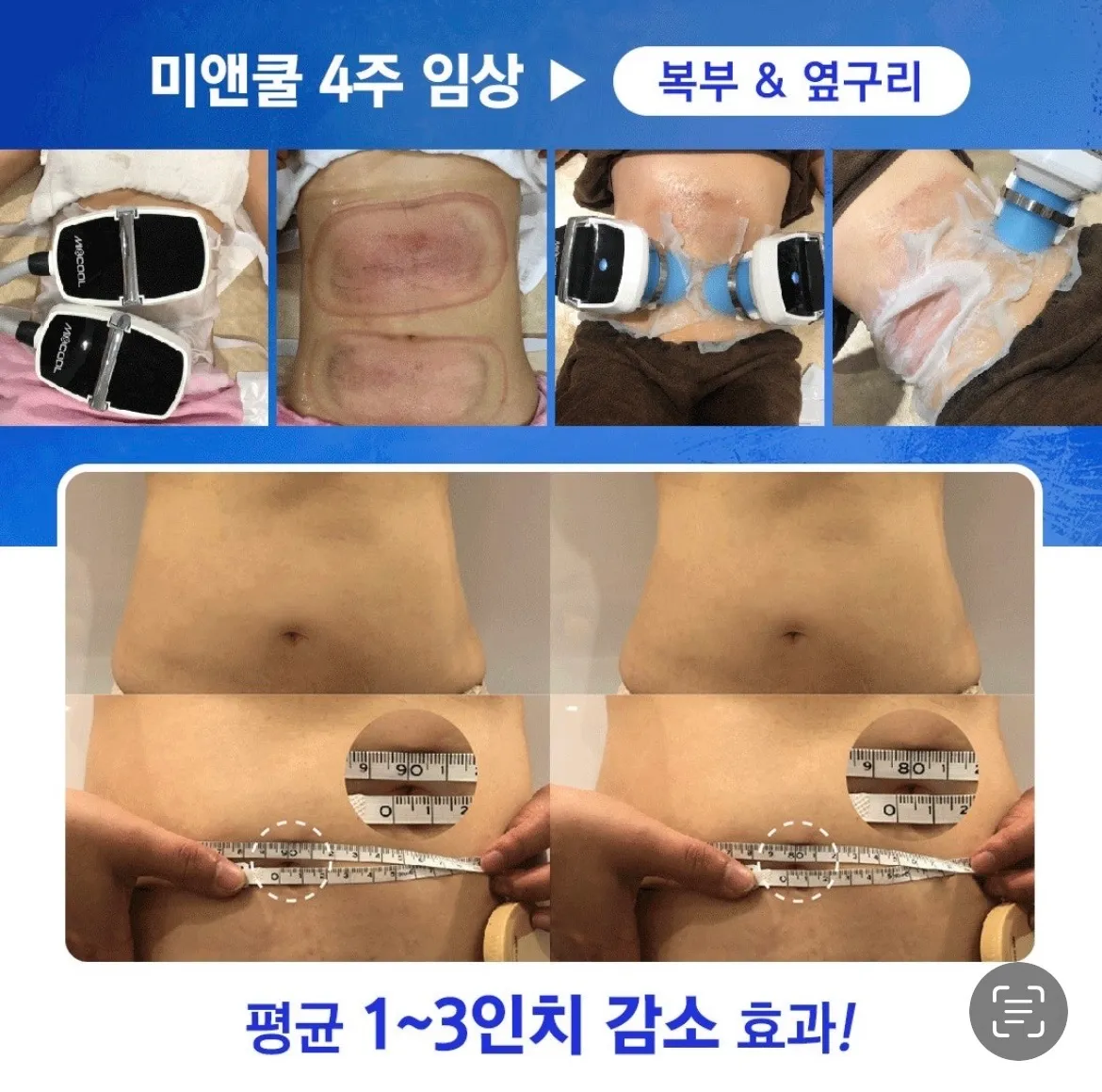 이미지 10