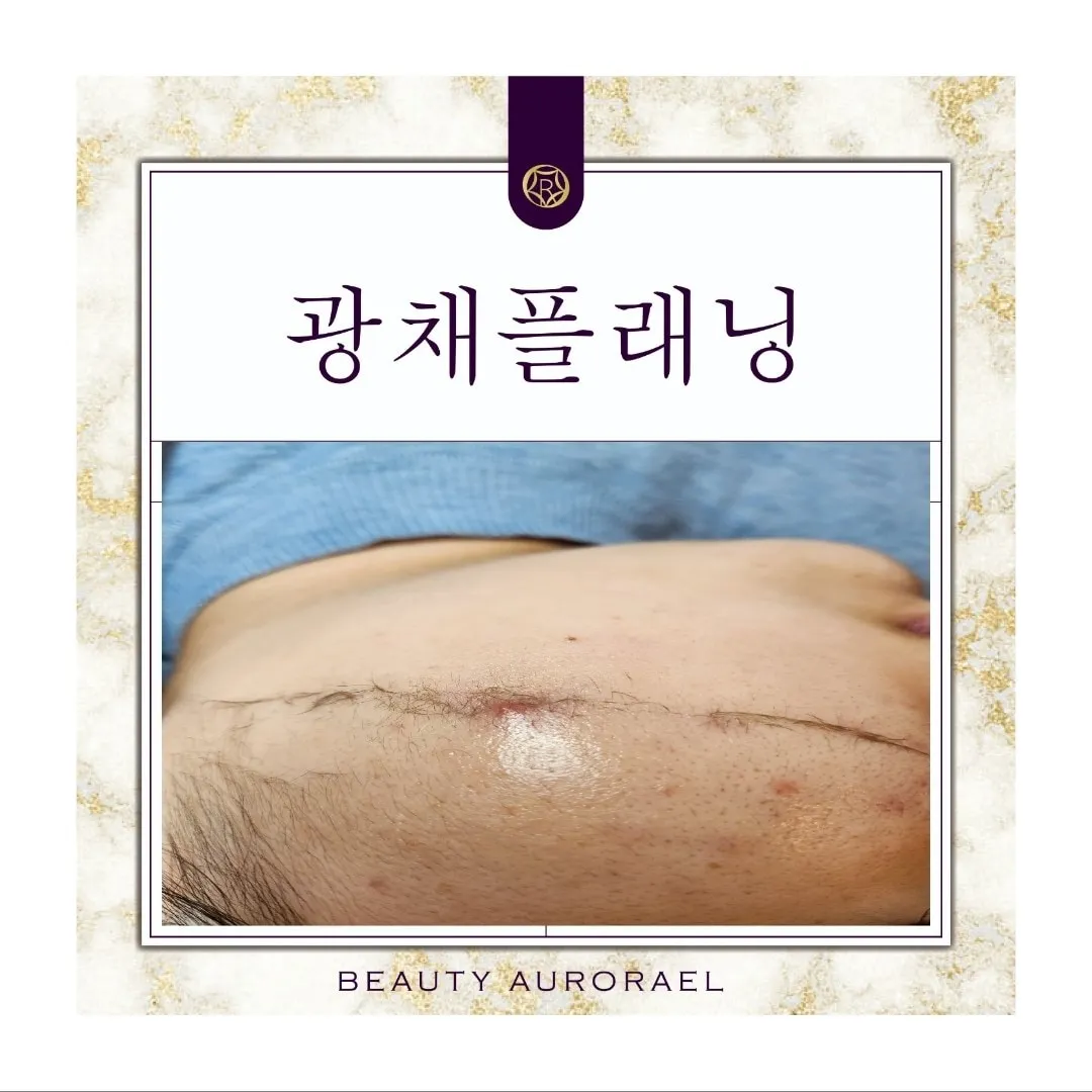 이미지 8