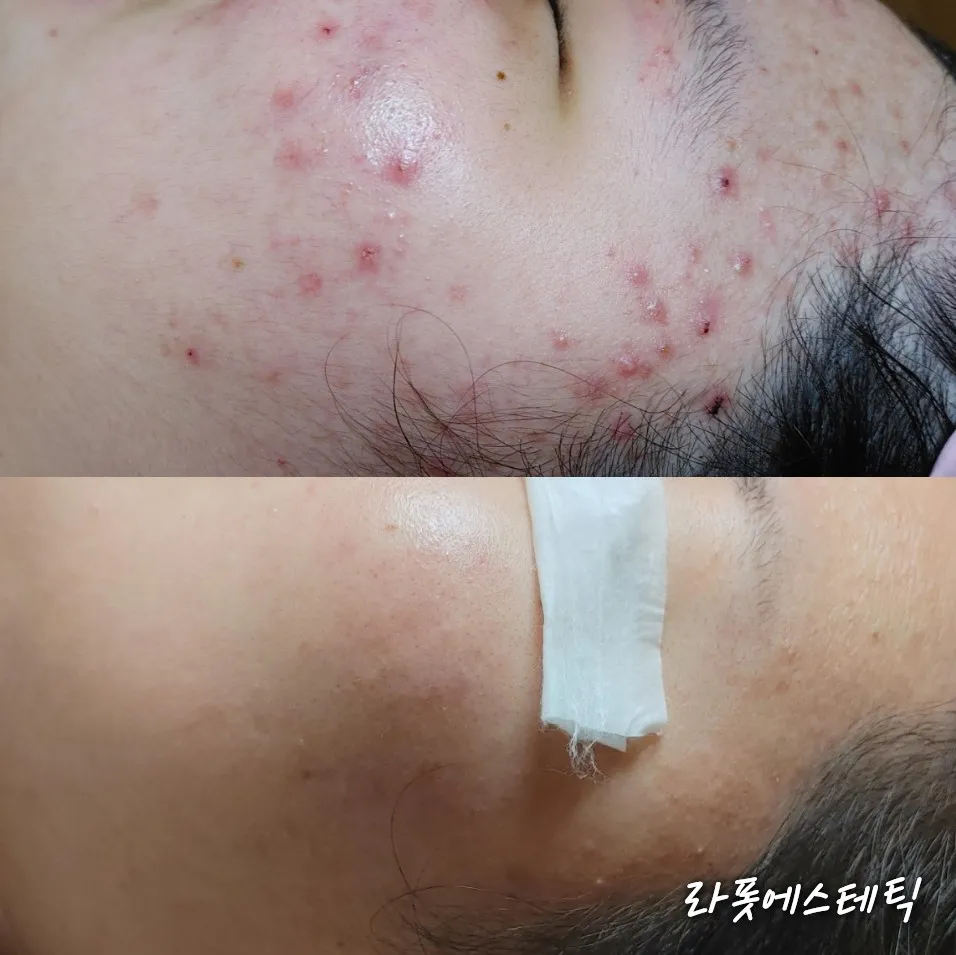 이미지 3
