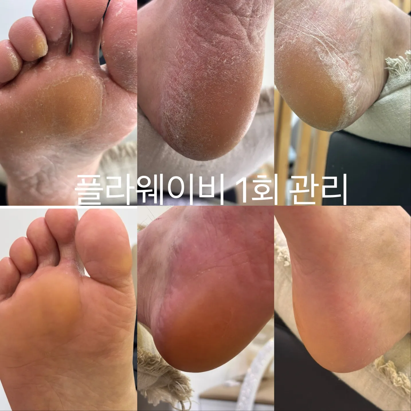 이미지 10