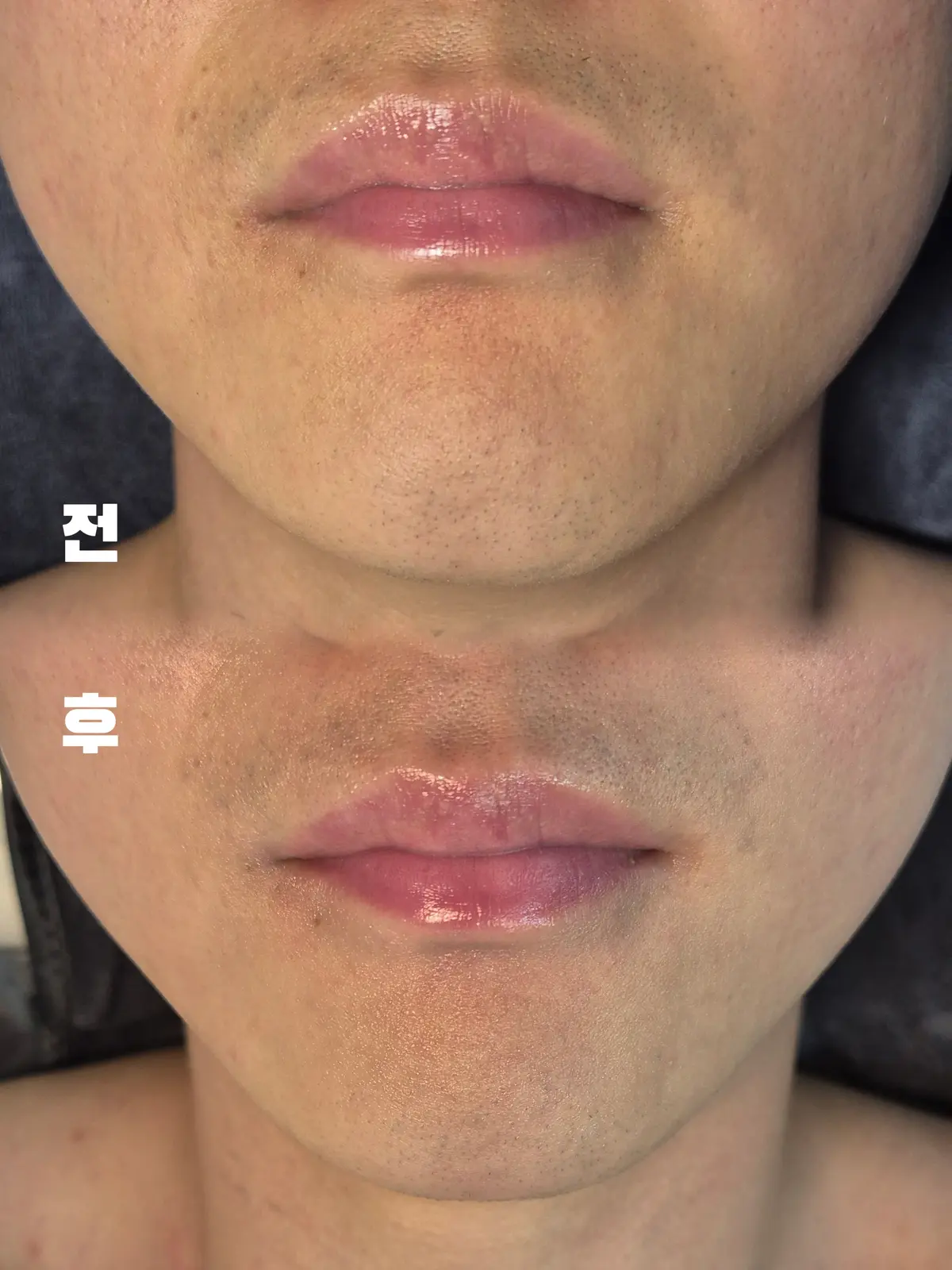 이미지 4